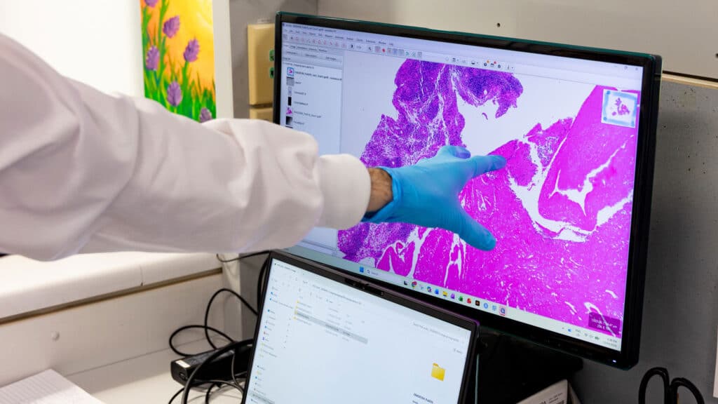 Arthritis australia tissue scan histology research arthritis