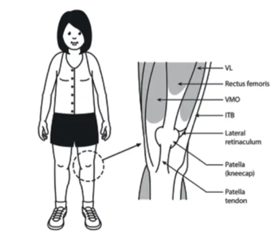 causes of anterior knee pain