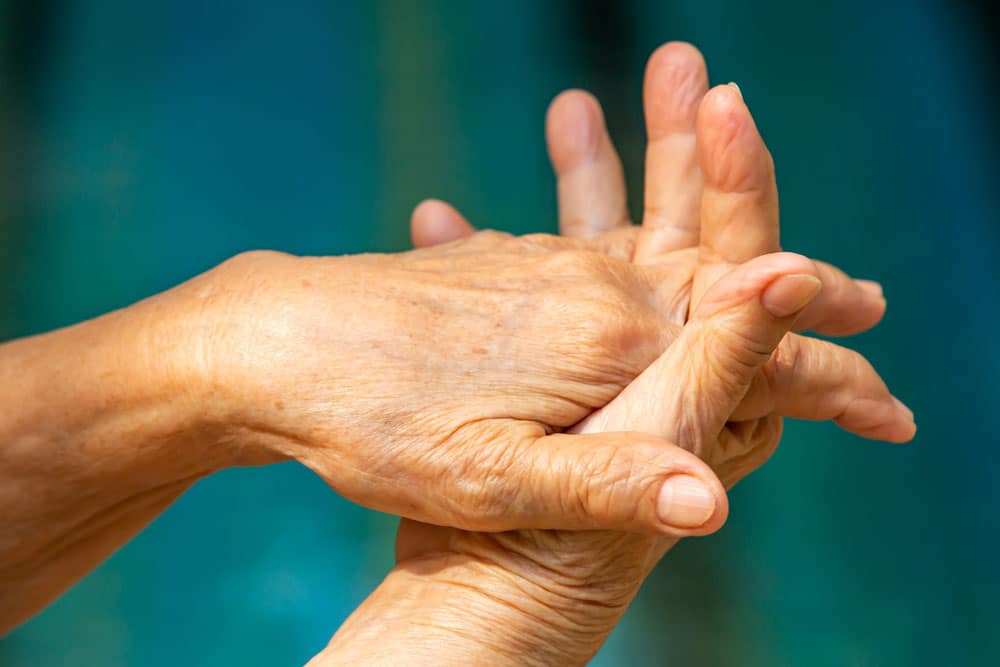 Arthritis in the hands
