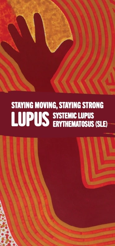 info sheet lupus smss