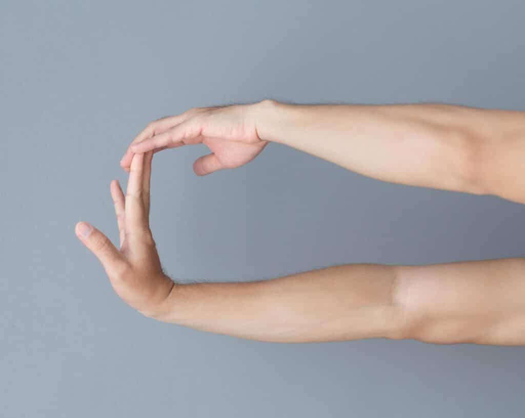 Joint hypermobility