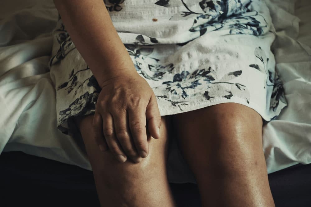 Knee arthritis