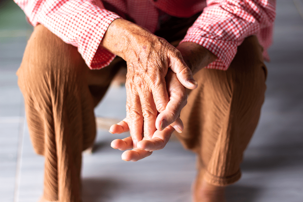 Psoriatic arthritis