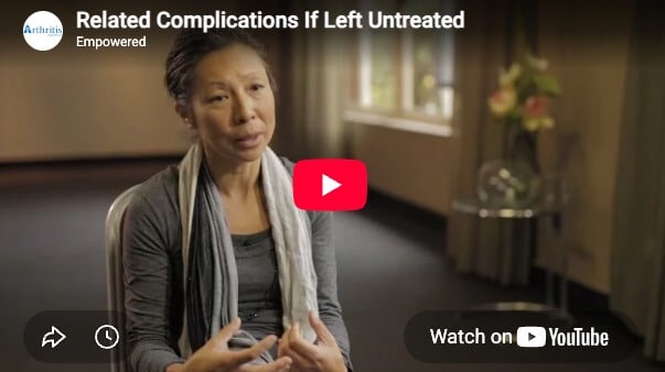 rheumatoid-arthritis-related-complications-if-left-untreated