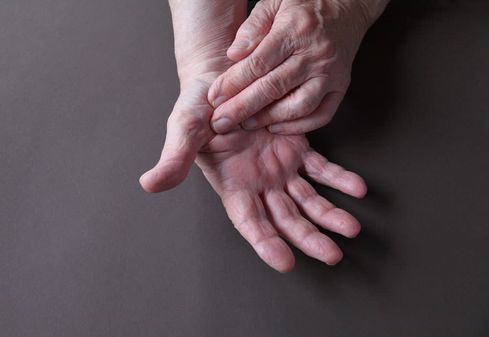 Rheumatoid arthritis