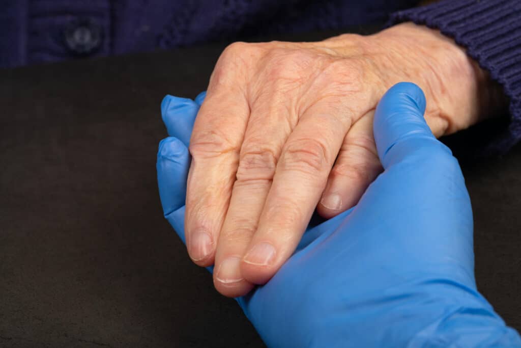 Scleroderma