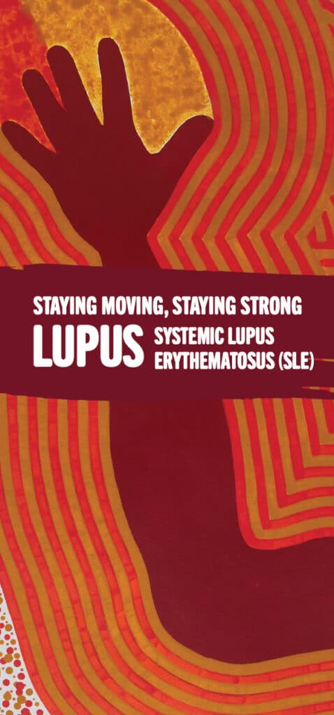 Lupus smss