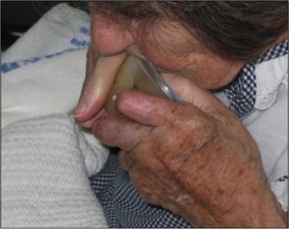 Patient opening packaging with teeth